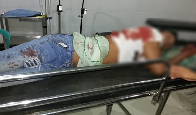 Nonton Cilokak, Warga Jerowaru Ditebas di Jalan