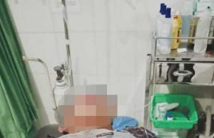 Maling Motor di Praya, Mukanya Babak Belur Dihajar Warga Sampai Pingsan