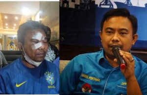 Dikeroyok Sampai Babak Belur, Ketum KNPI Haris Pratama Minta Perlindungan