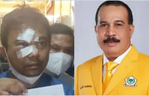 Politisi Golkar Jadi Tersangka. Diduga Dalang Pengeroyokan Ketum KNPI. Begini Kata Polisi